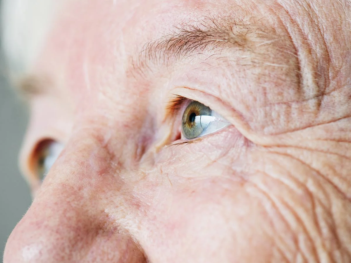 Síntomas de cataratas en adultos mayores