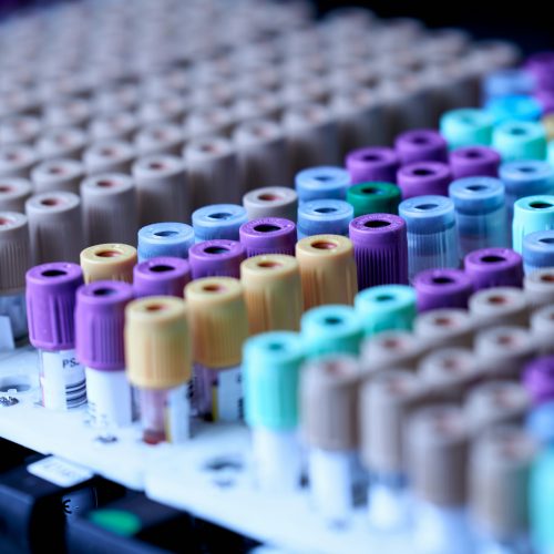 Tubos de muestras de sangre en una bandeja